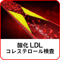 酸化LDLコレステロール 検査