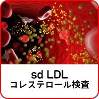 sd LDLコレステロール 検査